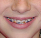 orthodontics